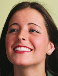 A girl smiling after teeth bonding treatment